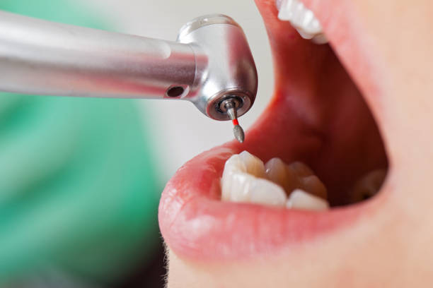 Best Emergency Treatment for Oral Infections in Joplin, MO